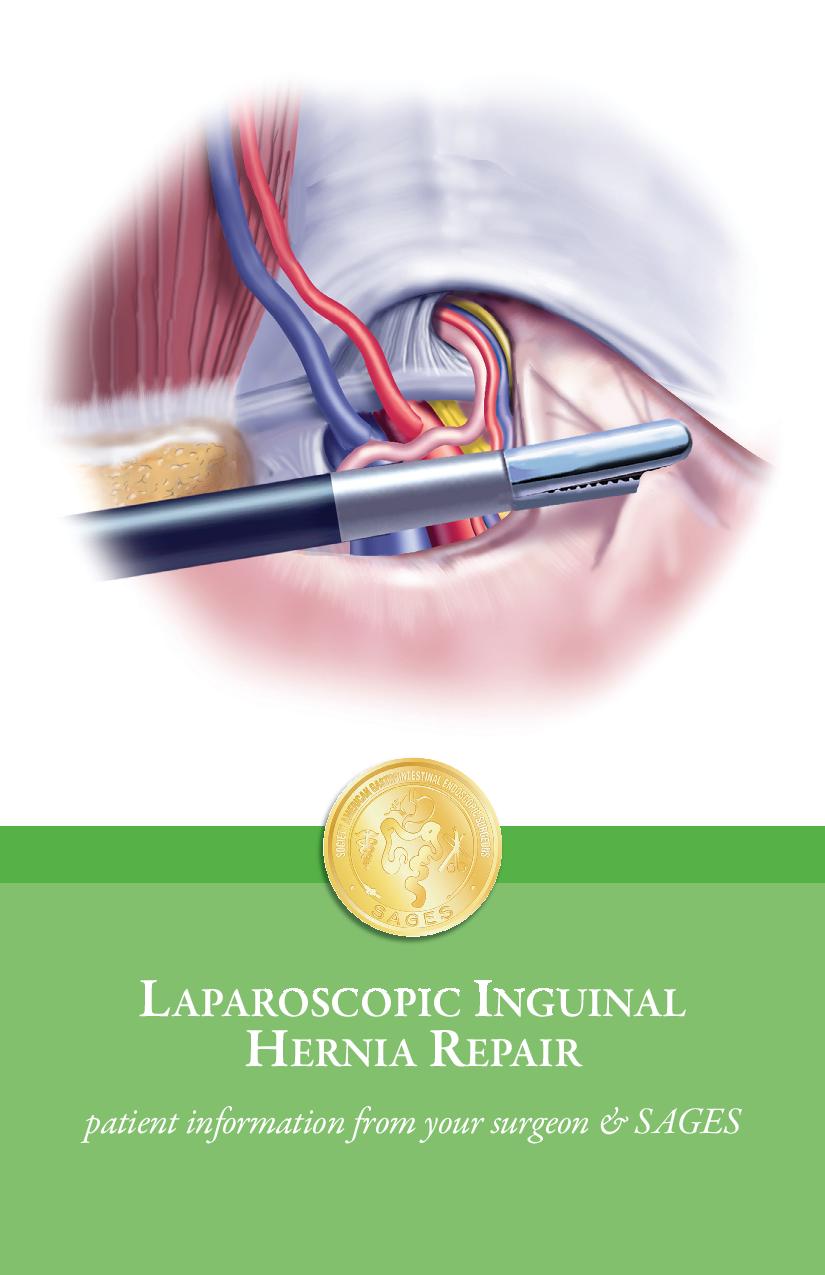 Inguinal Hernia Surgical Anatomy