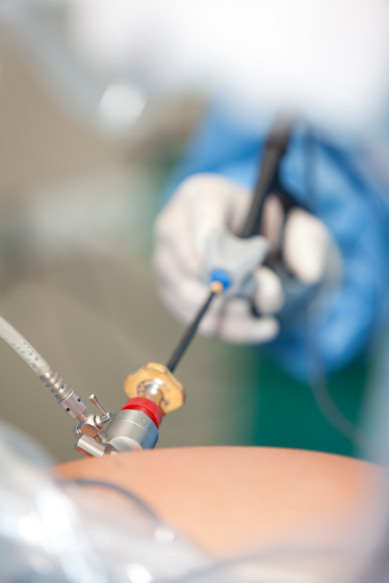minimally invasive surgery