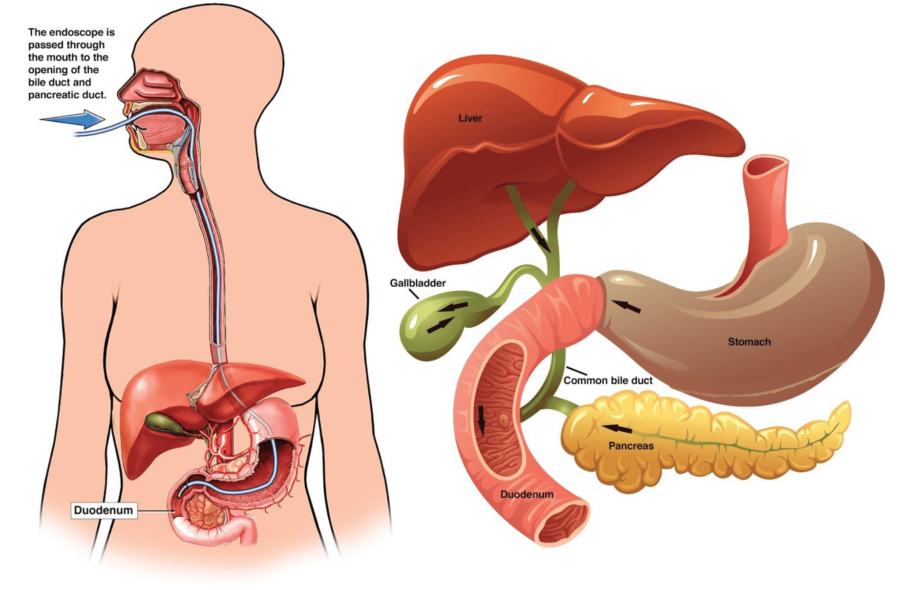 SAGES Patient Information ERCP