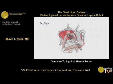 Overview inguinal hernia repair from the SAGES Video Library