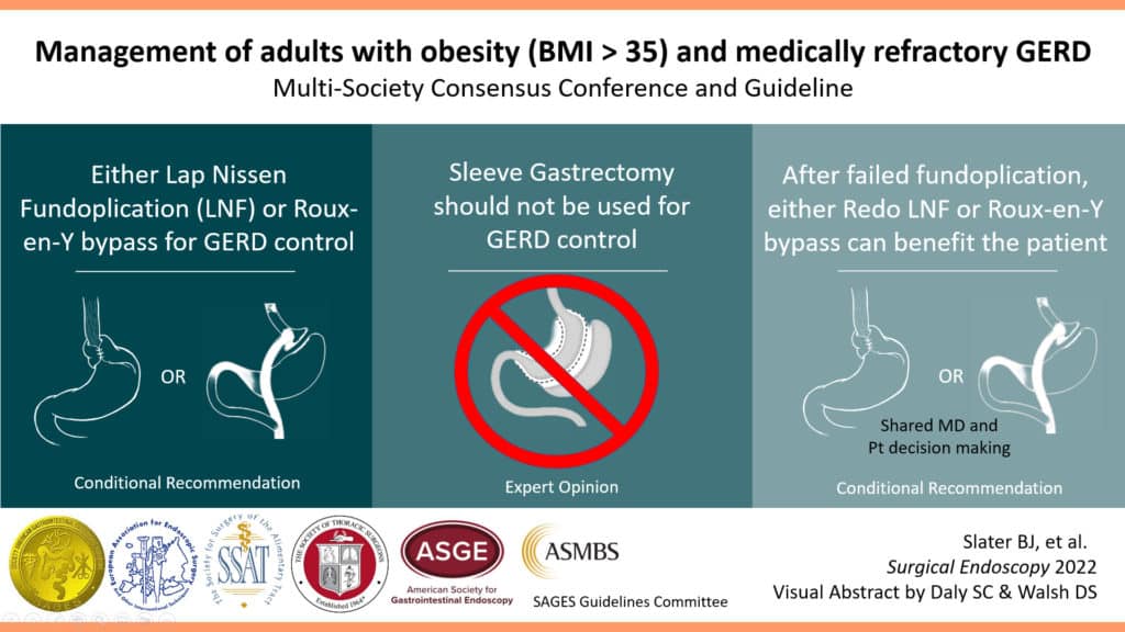 Management of adults with obesity (BMI > 35) and medically refractory GERD