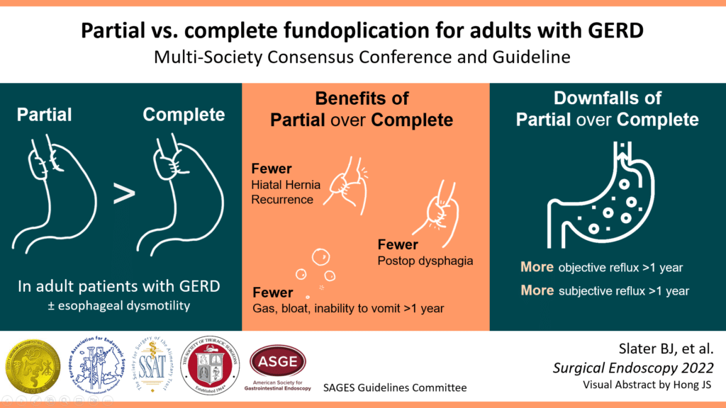 Partial vs. complete fundoplication for adults with GERD
