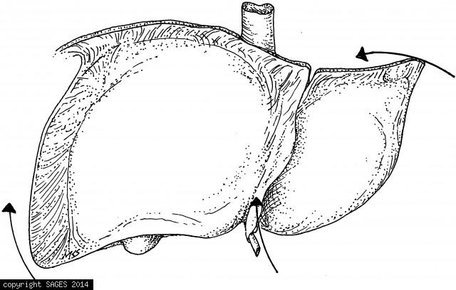 vector illustration of diagram of human liver anatomy:: tasmeemME.com