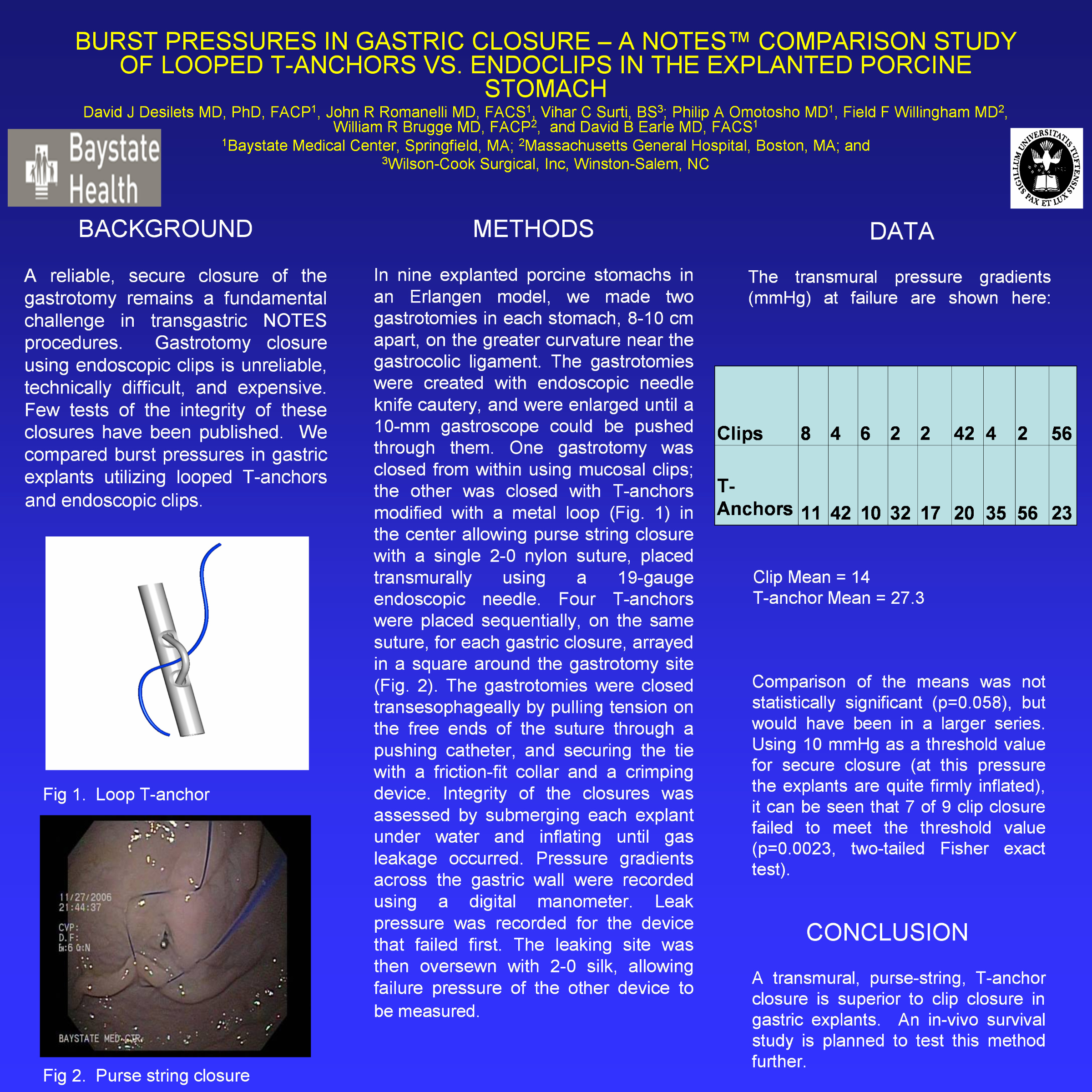 The management of cervical incompetence by purse-string suture