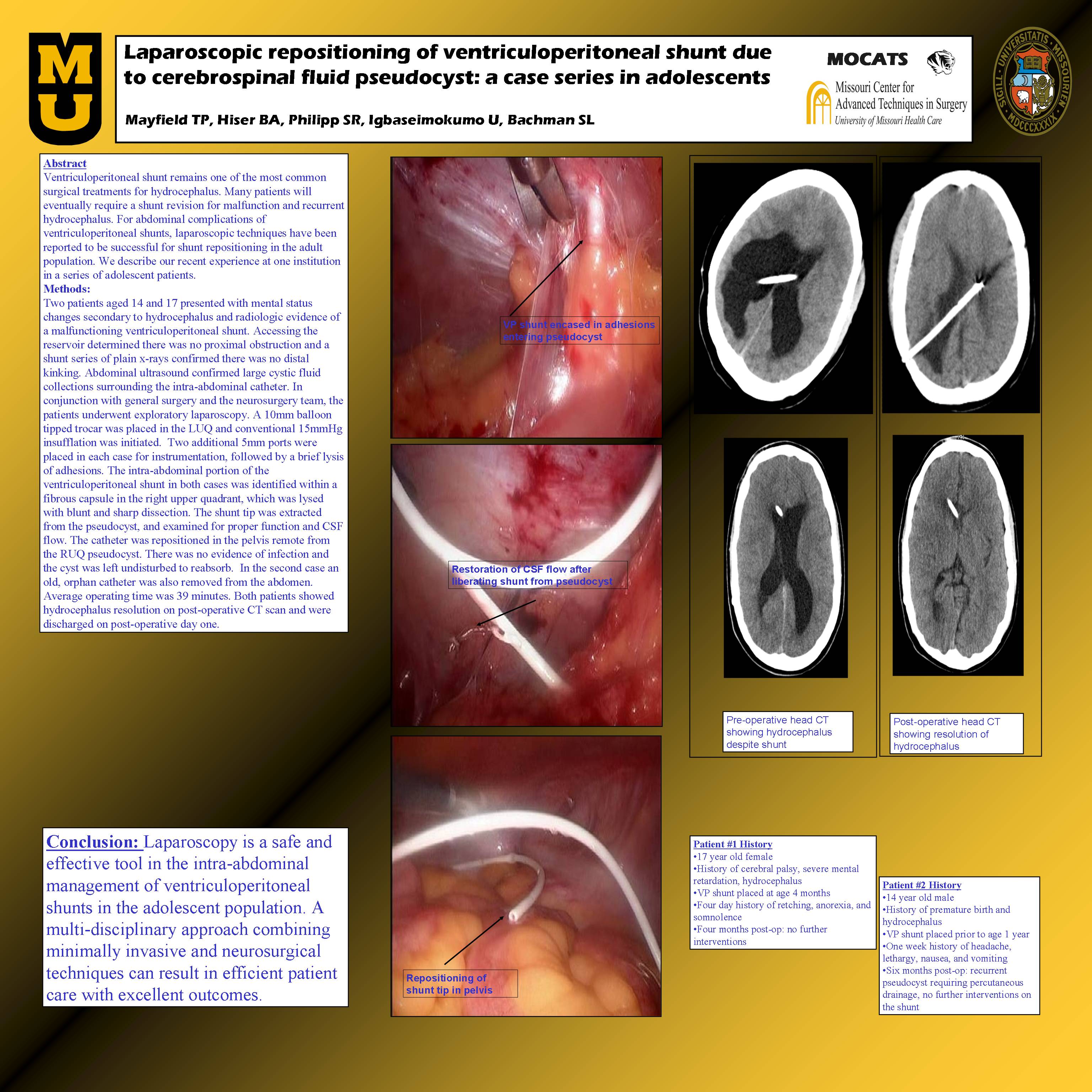 Laparoscopic Repositioning of Ventriculoperitoneal Shunt Due to  Cerebrospinal Fluid Pseudocyst: A Case Series in Adolescents - SAGES  Abstract Archives