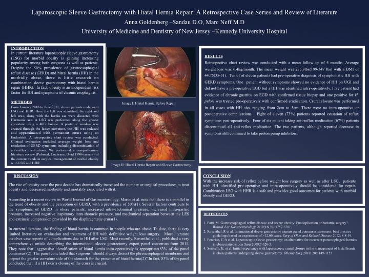 What are the risks of a hiatal hernia surgery?