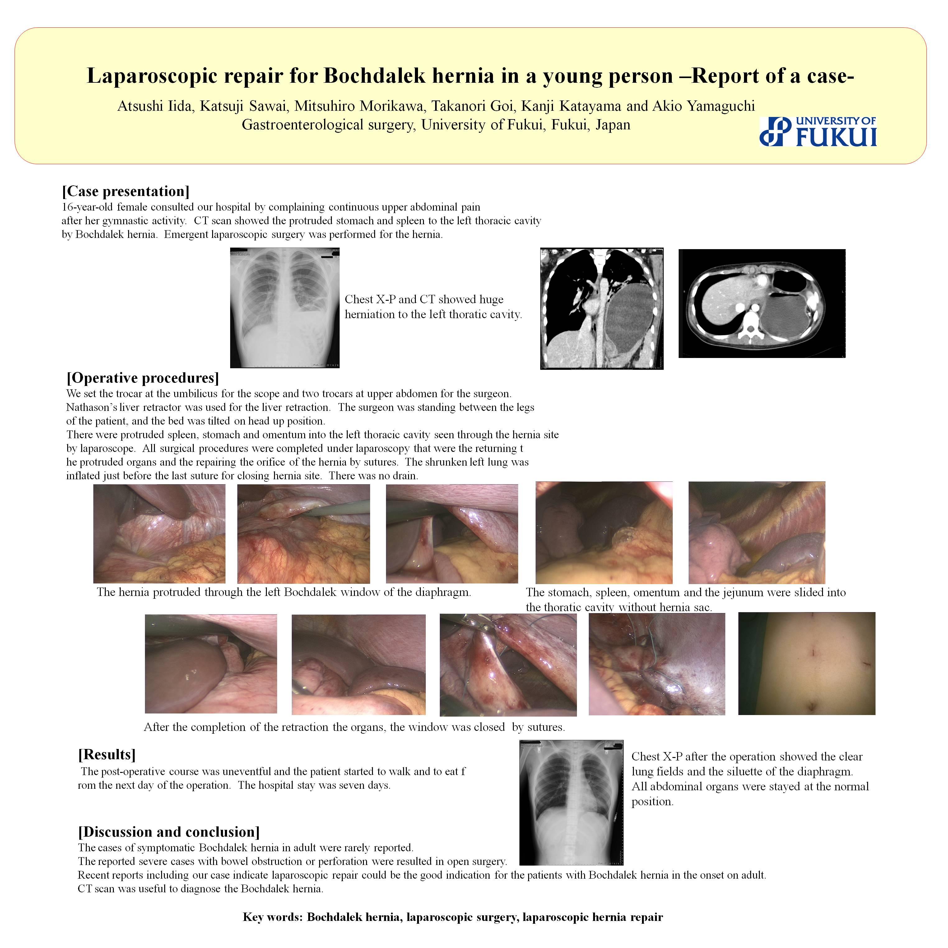 Laparoscopic Repair For A Bochdalek Hernia In Young Person Report Of