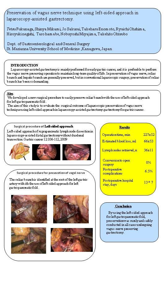 Preservation of Vagus Nerve Technique Using Left-sided Approach in