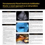 Ventriculo-Gallbladder Shunt